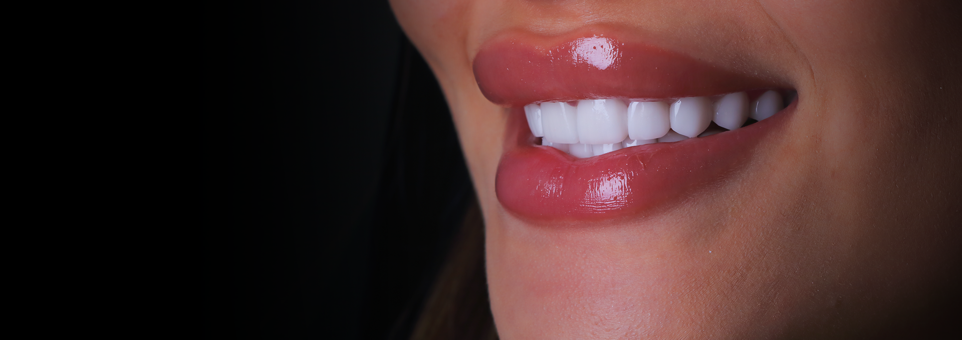 E-MAX 6D Hollywood Smile