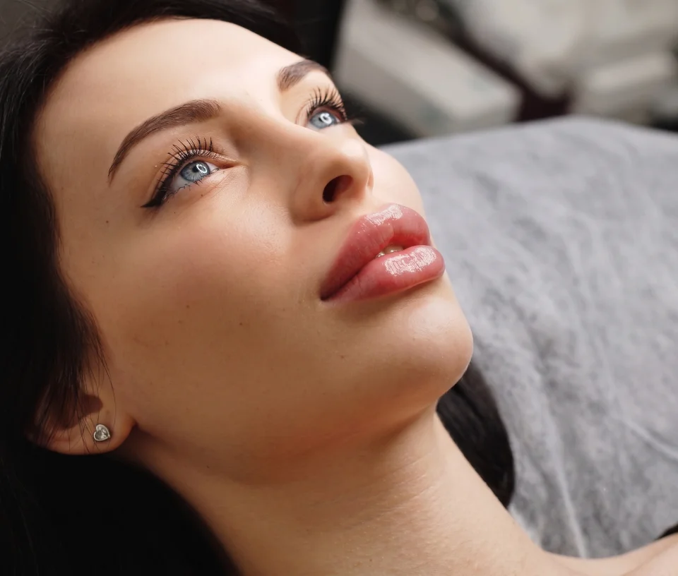Dermal Fillers