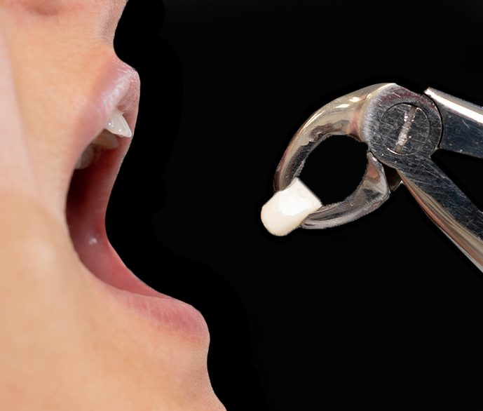 Dental Surgery