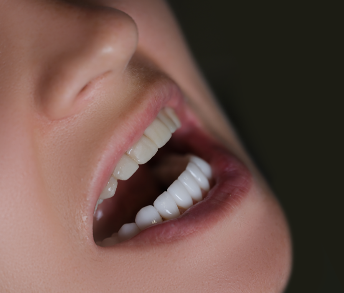 Teeth Whitening